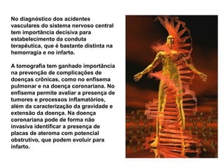 No diagnóstico dos acidentes
vasculares do sistema nervoso central
tem importância decisiva para
estabelecimento da conduta
terapêutica, que é bastante distinta na
hemorragia e no infarto.

A tomografia tem ganhado importância
na prevenção de complicações de
doenças crônicas, como no enfisema
pulmonar e na doença coronariana. No
enfisema permite avaliar a presença de
tumores e processos inflamatórios,
além da caracterização da gravidade e
extensão da doença. Na doença
coronariana pode de forma não
invasiva identificar a presença de
placas de ateroma com potencial
obstrutivo, que podem evoluir para
infarto.
 