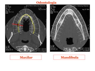 Odontologia




Maxilar                 Mandíbula
 
