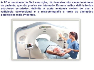 A TC é um exame de fácil execução, não invasivo, não causa incómodo
ao paciente, que não precisa ser internado. Da uma melhor definição das
estruturas estudadas, delimita a exata anatomia melhor do que a
radiologia convencional e a ultra-sonografia e torna as alterações
patológicas mais evidentes.
 