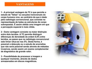 VANTAGENS


1 - A principal vantagem da TC é que permite o
estudo de "fatias" ou secções transversais do
corpo humano vivo, ao contrário do que é dado
pela radiologia convencional, que consiste na
representação de todas as estruturas do corpo
sobrepostas. É assim obtida uma imagem em que
a percepção espacial é mais nítida.

2 - Outra vantagem consiste na maior distinção
entre dois tecidos. A TC permite distinguir
diferenças de densidade da ordem 0,5% entre
tecidos, ao passo que na radiologia convencional
este limiar situa-se nos 5%. Desta forma, é
possível a detecção ou o estudo de anomalias
que não seria possível senão através de métodos
invasivos, sendo assim um exame complementar
de diagnóstico de grande valor.

3 - Possibilidade de processar a imagem a
qualquer momento, através de dados
armazenados em discos magnéticos.
 
