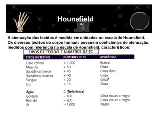 Hounsfield

A atenuação dos tecidos é medida em unidades ou escala de Hounsfield.
Os diversos tecidos do corpo humano possuem coeficientes de atenuação,
medidos com referencia na escala de Hounsfield, característicos:
 