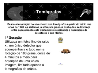 Tomógrafos

 Desde a introdução do uso clínico dos tomógrafos a partir do início dos
  anos de 1970, os sistemas já sofreram grandes evoluções. A diferença
    entre cada geração esta diretamente relacionada a quantidade de
                        detectores e sua fileiras.

1ª Geração
Utilizava um feixe fino de raios
x , um único detector que
acompanhava o tubo numa
rotação de 180 graus, cerca de
4 minutos e meio para
obtenção de uma única
imagem, limitado apenas a
tomografias de crânio.
 