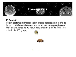 Tomógrafos


2º Geração
Foram bastante melhorados com o feixe de raios x em forma de
leque com 30 ou mais detectores os tempos de exposição eram
mais curtos, cerca de 15 segundos por corte, e ainda limitado a
rotação de 180 graus.
 