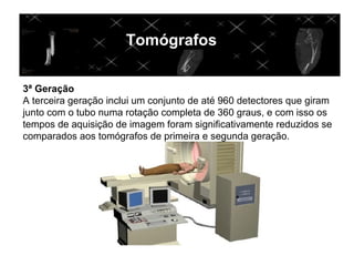 Tomógrafos

3ª Geração
A terceira geração inclui um conjunto de até 960 detectores que giram
junto com o tubo numa rotação completa de 360 graus, e com isso os
tempos de aquisição de imagem foram significativamente reduzidos se
comparados aos tomógrafos de primeira e segunda geração.
 