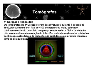 Tomógrafos
                                                     lllllllllllllllllllllllllllll
4ª Geração ( Helicoidal)
Os tomógrafos de 4ª Geração foram desenvolvidos durante a década de
1980, possuem um anel fixo de 4800 detectores ou mais, cobrindo
totalmente o círculo completo do gantry, sendo assim a fileira de detector
não acompanha mais a rotação do tubo. Por meio de movimentos rotatórios
contínuos, curtos feixes de radiação são emitidos o que propicia menores
tempos de aquisição.
 