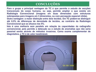 CONCLUÇÕES
Para o grupo a principal vantagem da TC é que permite o estudo de secções
transversais do corpo humano, ou seja, permite ampliar o que existia em
Radiologia Convencional (imagens em duas dimensões com estruturas
sobrepostas para imagens em 3 dimensões, ou com percepção espacial nítida).
Outra vantagem: a maior distinção entre dois tecidos. Em TC podem-se distinguir
até 0,5% de diferenças de densidade de tecidos, ao contrário da Radiologia
Convencional que se situava nos 5%.
Isto é uma melhoria sem paralelo em relação às capacidades da radiografia
convencional, pois permite a detecção ou o estudo de anomalias que não seria
possível senão através de métodos invasivos. Como exame complementar de
diagnóstico, a TC é de valor inestimável.
 