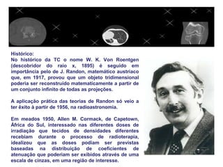 Histórico:
No histórico da TC o nome W. K. Von Roentgen
(descobridor do raio x, 1895) é seguido em
importância pelo de J. Randon, matemático austríaco
que, em 1917, provou que um objeto tridimensional
poderia ser reconstruído matematicamente a partir de
um conjunto infinito de todas as projeções.

A aplicação prática das teorias de Randon só veio a
ter êxito à partir de 1956, na radioastronomia.

Em meados 1950, Allen M. Cormack, de Capetown,
África do Sul, interessado nas diferentes doses de
irradiação que tecidos de densidades diferentes
recebiam durante o processo de radioterapia,
idealizou que as doses podiam ser previstas
baseadas na distribuição de coeficientes de
atenuação que poderiam ser exibidos através de uma
escala de cinzas, em uma região de interesse.
 