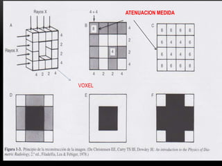 ATENUACION MEDIDA
VOXEL
 