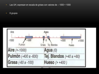 • Las UH, expresan en escala de grises con valores de – 1000 + 1000
• 6 grupos
 