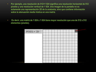 • Por ejemplo, una resolución de 512×1 024 significa una resolución horizontal de 512
píxeles y una resolución vertical de 1 024. Una imagen de la pantalla no es
solamente una representación 2D de la anatomía, sino que contiene información
sobre la atenuación media hística en una matriz.
• Es decir, una matriz de 1 024 x 1 024 tiene mayor resolución que una de 512 x 512
elementos (píxeles).
 