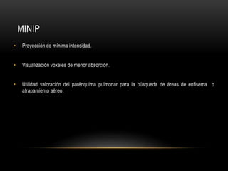 MINIP
• Proyección de mínima intensidad.
• Visualización voxeles de menor absorción.
• Utilidad valoración del parénquima pulmonar para la búsqueda de áreas de enfisema o
atrapamiento aéreo.
 