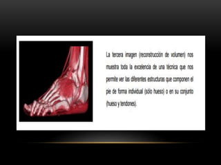 Física en tomografía computarizada