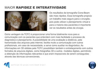 p a r t i c i p e d o g r u p o c o n e b e a m b r a s i l
Os resultados da tomografia Cone-Beam
são mais rápidos. Essa tomografia propicia
um trabalho mais seguro para o cirurgião,
pois pode utilizar o planejamento virtual e
para a maioria dos pacientes é importante
ver os resultados antes da cirurgia.
Outra vantagem da TCFC é proporcionar uma forma totalmente nova para a
comunicação com os pacientes que entendem com mais facilidade o processo de
diagnóstico e planejamento. A possibilidade de uma avaliação a distância, pela
transmissão dos arquivos pela internet, facilita muito a comunicação com outros
profissionais, em caso de necessidade, e serve como auxiliar no diagnóstico. As
informações em 3D obtidas pela TCFC possibilitam também o entrelaçamento com outros
formatos de arquivos digitais, como fotografias 3D e outros modelos digitais, permitindo
a obtenção de informações relevantes e que eram impossíveis de serem conseguidas
através das técnicas convencionais.
MAIOR RAPIDEZ E INTERATIVIDADE
 