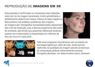 p a r t i c i p e d o g r u p o c o n e b e a m b r a s i l
Esta precisão é confirmada no comparativo das medições
reais com as da imagem escaneada. A alta sensibilidade e
detalhamento determinam baixos índices de falso-negativo e
falso-positivo nas análises qualitativas das imagens.
As imagens das Tomografias Computadorizadas apresentam
alto nível de resolução, pois a técnica proporciona alto poder
de contraste, permitindo que pequenas diferenças teciduais
possam ser evidenciadas e interpretadas em milhares de
tons de cinza em cada pixel.
Todo esse progresso naturalmente vem na esteira da
tecnologia digital que, além de tudo, ainda permite
melhorias na qualidade da imagem através de técnicas
de computação gráficas extremamente precisas.
Cirurgiões-dentistas, em determinados casos, precisam
REPRODUÇÃO DE IMAGENS EM 3D
 