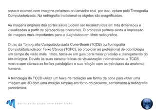 p a r t i c i p e d o g r u p o c o n e b e a m b r a s i l
possuir exames com imagens próximas ao tamanho real, por isso, optam pela Tomografia
Computadorizada. Na radiografia tradicional os objetos são magnificados.
As imagens originais dos cortes axiais podem ser reconstruídas em três dimensões e
visualizadas a partir de perspectivas diferentes. O processo permite ainda a impressão
de imagens mais importantes para o diagnóstico em filme radiográfico.
O uso da Tomografia Computadorizada Cone-Beam (TCCB) ou Tomografia
Computadorizada por Feixe Cônico (TCFC), ao propiciar ao profissional de odontologia
um campo de visão mais nítido, torna-se um guia para maior precisão e planejamento do
ato cirúrgico. Devido às suas características de visualização tridimensional, a TCCB
mostra com clareza as lesões patológicas e sua relação com as estruturas da anatomia
humana.
A tecnologia do TCCB utiliza um feixe de radiação em forma de cone para obter uma
imagem em 3D com uma rotação simples em torno do paciente, semelhante à radiografia
panorâmica.
 