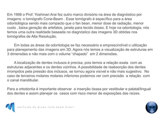 p a r t i c i p e d o g r u p o c o n e b e a m b r a s i l
Em 1998 o Prof. Yoshinari Arai fez outro marco divisório na área de diagnóstico por
imagens: o tomógrafo Cone-Beam . Esse tomógrafo é específico para a área
odontológica sendo mais compacto que o fan bean, menor dose de radiação, menor
custo , baixa geração de artefatos, janela para tecido ósseo. E hoje na odontologia, nós
temos uma outra realidade baseada no diagnóstico das imagens 3D obtidas nos
tomógrafos de Alta Resolução.
Em todas as áreas da odontologia se faz necessário e emprescindível o utilização
para planejamento das imagens em 3D. Agora nós temos a visualização de estruturas em
3 dimensões e não mais com o volume “chapado” em 2 dimensões.
A localização de dentes inclusos é precisa, pois temos a relação exata com as
estruturas adjacentes e os dentes vizinhos. A possibilidade de reabsorção dos dentes
irrompidos pela pressão dos inclusos, se tornou agora visível e não mais sugestivo. No
caso de terceiros molares molares inferiores podemos ver com precisão a relação com
o canal mandibular.
Para a ortodontia é importante observar a inserção óssea por vestibular e palatal/lingual
dos dentes e assim planejar os casos com risco menor de exposições das raízes.
 