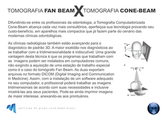 p a r t i c i p e d o g r u p o c o n e b e a m b r a s i l
Difundindo-se entre os profissionais da odontologia, a Tomografia Computadorizada
Cone-Beam alcança cada vez mais consultórios, aperfeiçoa sua tecnologia provando seu
custo-benefício, em aparelhos mais compactos que já fazem parte do cenário das
modernas clínicas odontológicas.
As clínicas radiológicas também estão avançando para o
diagnóstico de padrão 3D. A maior exatidão nos diagnósticos ao
se trabalhar com a tridimensionalidade é indiscutível. Uma grande
vantagem desta técnica é que os programas que trabalham com
as imagens podem ser instalados em computadores comuns,
não exigindo a aquisição de uma estação de trabalho especial
como é o caso do tomógrafo Fan Beam. As duas exportam
arquivos no formato DICOM (Digital Imaging and Communication
in Medicine). Assim, com a instalação de um software adequado
no seu computador, o profissional poderá trabalhar as imagens
tridimensionais de acordo com suas necessidades e inclusive
mostrá-las aos seus pacientes. Pode-se ainda imprimir imagens
de maior interesse, anexando-as aos prontuários.
TOMOGRAFIA CONE-BEAM
X
TOMOGRAFIA FAN BEAM
 