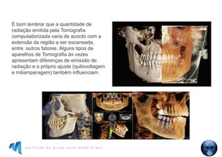 p a r t i c i p e d o g r u p o c o n e b e a m b r a s i l
É bom lembrar que a quantidade de
radiação emitida pela Tomografia
computadorizada varia de acordo com a
extensão da região a ser escaneada,
entre outros fatores. Alguns tipos de
aparelhos de Tomografia às vezes
apresentam diferenças de emissão de
radiação e o próprio ajuste (quilovoltagem
e miliamperagem) também influenciam.
 