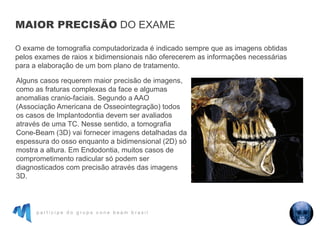 p a r t i c i p e d o g r u p o c o n e b e a m b r a s i l
Alguns casos requerem maior precisão de imagens,
como as fraturas complexas da face e algumas
anomalias cranio-faciais. Segundo a AAO
(Associação Americana de Osseointegração) todos
os casos de Implantodontia devem ser avaliados
através de uma TC. Nesse sentido, a tomografia
Cone-Beam (3D) vai fornecer imagens detalhadas da
espessura do osso enquanto a bidimensional (2D) só
mostra a altura. Em Endodontia, muitos casos de
comprometimento radicular só podem ser
diagnosticados com precisão através das imagens
3D.
O exame de tomografia computadorizada é indicado sempre que as imagens obtidas
pelos exames de raios x bidimensionais não oferecerem as informações necessárias
para a elaboração de um bom plano de tratamento.
MAIOR PRECISÃO DO EXAME
 