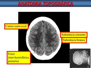 ANATOMIA TOPOGRÁFICA 
Foice 
inter-hemisférica 
posterior Substância cinzenta 
Centro semi-oval 
Substância branca  