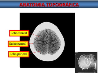 ANATOMIA TOPOGRÁFICA 
Lobo frontal 
Sulco central 
Lobo parietal  