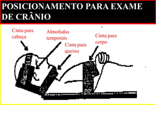 Cinta para 
corpo 
Cinta para 
queixo 
Almofadas 
temporais 
Cinta para 
cabeça 
POSICIONAMENTO PARA EXAME DE CRÂNIO  