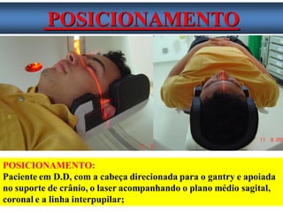 POSICIONAMENTO 
POSICIONAMENTO: 
Paciente em D.D, com a cabeça direcionada para o gantry e apoiada no suporte de crânio, o laser acompanhando o plano médio sagital, coronal e a linha interpupilar;  