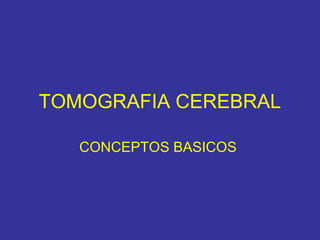 TOMOGRAFIA CEREBRAL
CONCEPTOS BASICOS
 