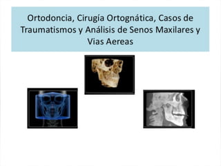 Tomografia de haz conico / Cone Beam en odontologia | PDF