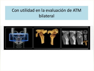 Tomografia de haz conico / Cone Beam en odontologia | PDF