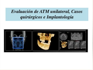 Tomografia de haz conico / Cone Beam en odontologia | PDF
