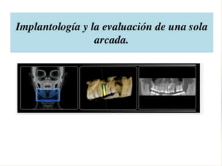 Tomografia de haz conico / Cone Beam en odontologia | PDF