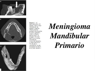 Tomografia de haz conico / Cone Beam en odontologia | PDF