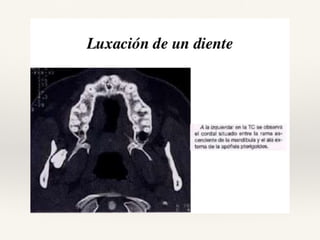 Tomografia de haz conico / Cone Beam en odontologia | PDF