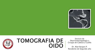 TOMOGRAFIA DE 
OIDO 
Servicio de 
Otorrinolaringología y 
Cirugía de Cabeza y Cuello 
Dr. Alan Burgos P. 
Residente de Segundo año 
 