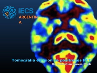 ARGENTIN
   A




Tomografía emision de positrones PET
                  Dr. Sebastián García Martí
 