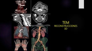 TEM
RECONSTRUCCIONES
3D
 