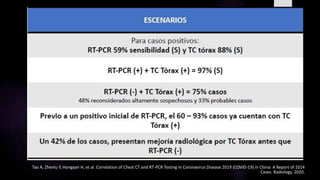 Tao A, Zhenlu Y, Hongyan H, et al. Correlation of Chest CT and RT-PCR Testing in Coronavirus Disease 2019 (COVID-19) in China: A Report of 1014
Cases. Radiology. 2020.
 