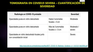 TOMOGRAFIA EN COVID19 SEVERA – CUANTIFICACIÓN DE
SEVERIDAD
 