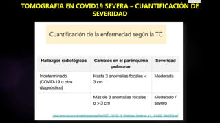 TOMOGRAFIA EN COVID19 SEVERA – CUANTIFICACIÓN DE
SEVERIDAD
 