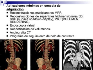 Aplicaciones mínimas en consola de adquisición Reconstrucciones múltiplanares MPR Reconstrucciones de superficies tridimensionales 3D, SSD (surface shadown display), VRT (VOLUMEN RENDERING) Endoscopia virtual Renderización de volúmenes. Angiografía CT Programa de seguimiento de bolo de contraste. 