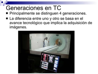 Generaciones en TC Principalmente se distinguen 4 generaciones. La diferencia entre uno y otro se basa en el avance tecnológico que implica la adquisición de imágenes. 