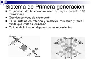 Sistema de Primera generación  El proceso de traslación-rotación se repite durante 180 traslaciones  Grandes periodos de exploración Es un sistema de rotación y traslación muy lento y tarda 5 min lo que limita su utilización Calidad de la imagen depende de los movimientos 