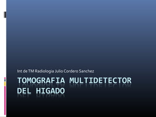 Int de TM Radiologia Julio Cordero Sanchez
 