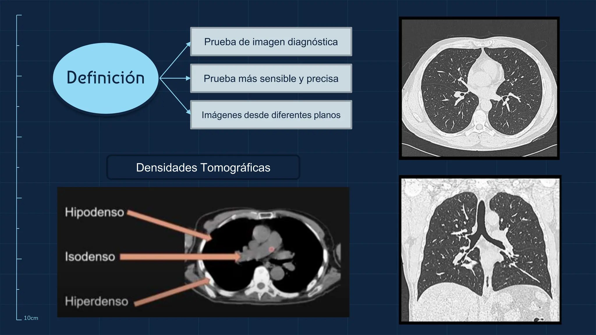 Torax Simple TOMOGRAFIA DE TORAX SIMPLE Y CON CONTRASTE | PPTX