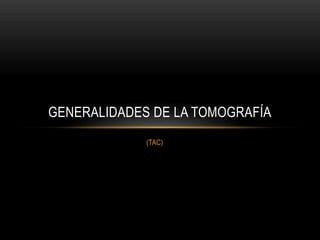 GENERALIDADES DE LA TOMOGRAFÍA
(TAC)
 