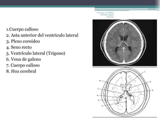 1.Cuerpo calloso 
2. Asta anterior del ventrículo lateral 
3. Plexo coroideo 
4. Seno recto 
5. Ventrículo lateral (Trígono) 
6. Vena de galeno 
7. Cuerpo calloso 
8. Hoz cerebral 
10010337- ALVAREZ 
CASTRO, Miguel 
Eduardo 
 