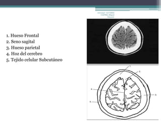 1. Hueso Frontal 
2. Seno sagital 
3. Hueso parietal 
4. Hoz del cerebro 
5. Tejido celular Subcutáneo 
10010337- ALVAREZ 
CASTRO, Miguel 
Eduardo 
 