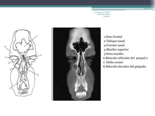 10010337- ALVAREZ 
CASTRO, Miguel 
Eduardo 
1.Seno frontal 
2.Tabique nasal 
3.Cornete nasal 
4.Maxilar superior 
5.Seno maxilar 
6.Musculo orbicular del parpad o 
7. Globo ocular 
8.Músculo elevador del párpado. 
 