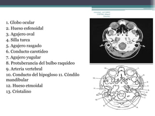 1. Globo ocular 
2. Hueso esfenoidal 
3. Agujero oval 
4. Silla turca 
5. Agujero rasgado 
6. Conducto carotideo 
7. Agujero yugular 
8. Protuberancia del bulbo raquídeo 
9. Arteria vertebral 
10. Conducto del hipogloso 11. Cóndilo 
mandibular 
12. Hueso etmoidal 
13. Cristalino 
10010337- ALVAREZ 
CASTRO, Miguel 
Eduardo 
 